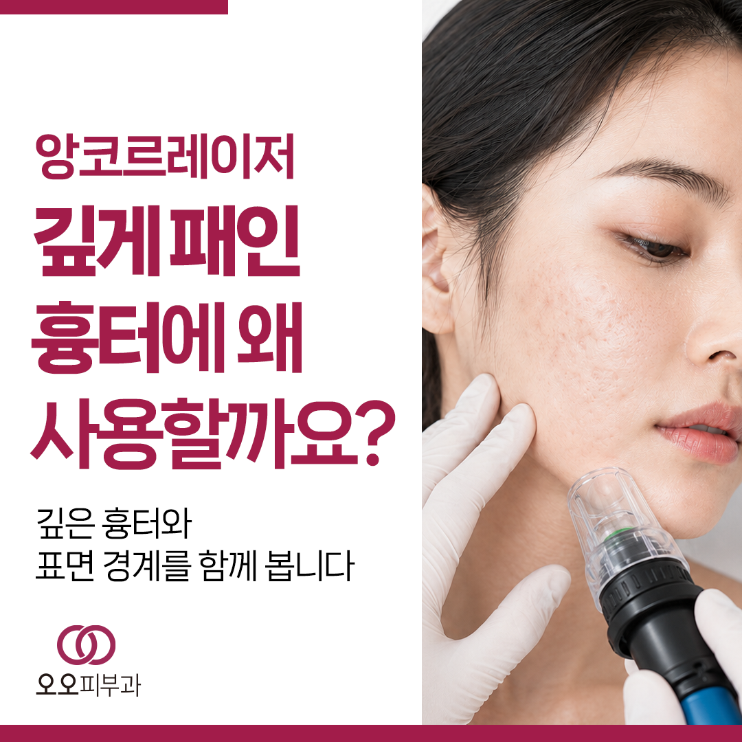 대구앙코르레이저 울트라펄스 앙코르 흉터 치료 장면